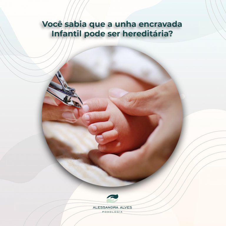 Tratamento para Unha Encravada em Crianças em Curitiba