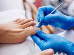 Espiculaectomia sem dor em Curitiba